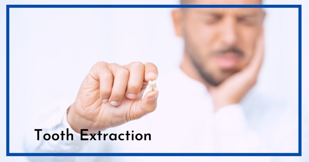 tooth extractions parma oh